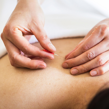 Therapist performing acupuncture treatment on a guest's shoulder at Amanemu spa.