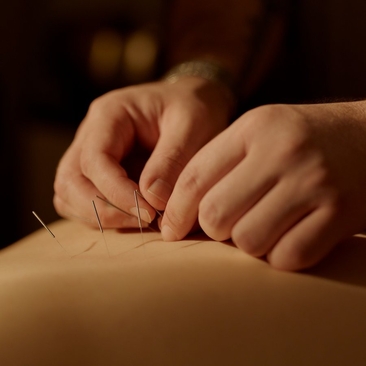 Acupuncture treatment at Amankora's wellness sanctuary, with practitioner's hands administering needle therapy.