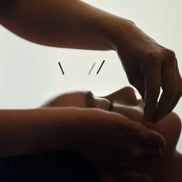 Terapeuta administrando acupuntura en la mano de un huésped en Aman Tokyo.