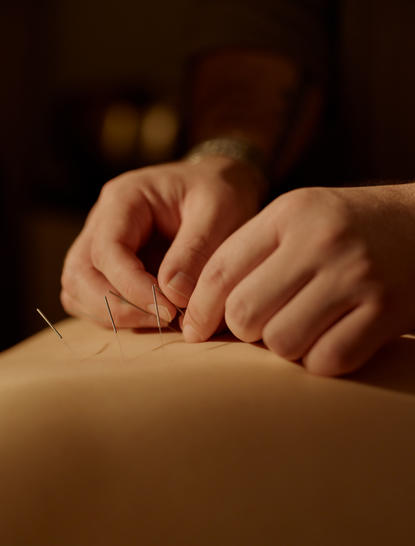 Terapeuta aplicando acupuntura nas costas de um hóspede no spa do Aman New York.